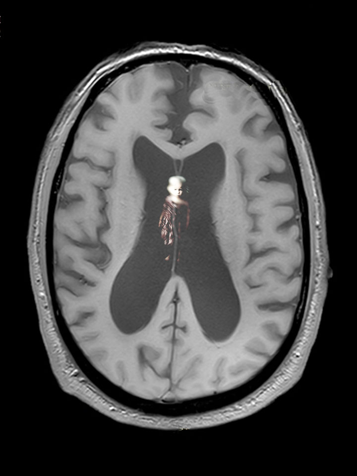 Vortrag_neurophysiologie_trauma_kunst